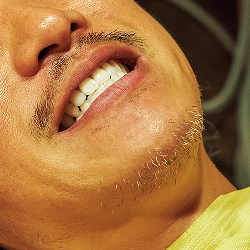 1時間ほどでピッカピカツルツルの歯に。