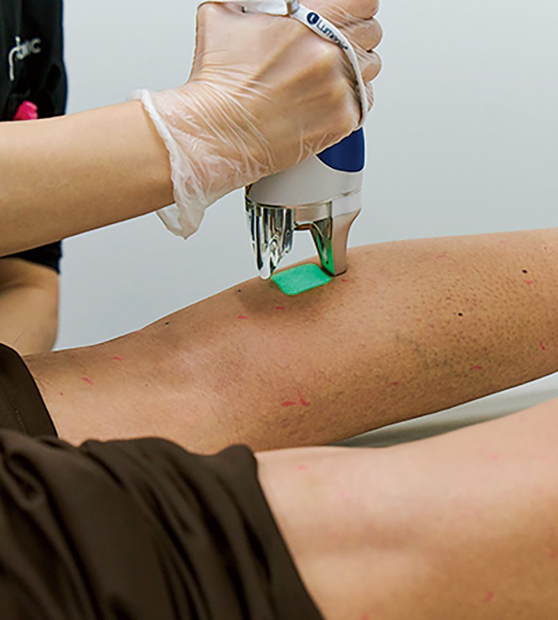 37歳オトコのスネ毛は「医療脱毛」でどうなる!?