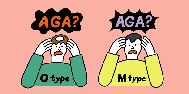 【Q1】AGAって薄毛のこと!? そもそもどういう意味?