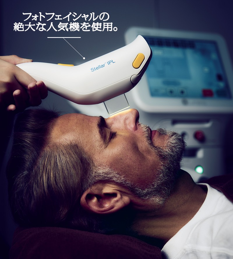 IPL(光治療)+イオン導入で、フワモチな肌に変身!