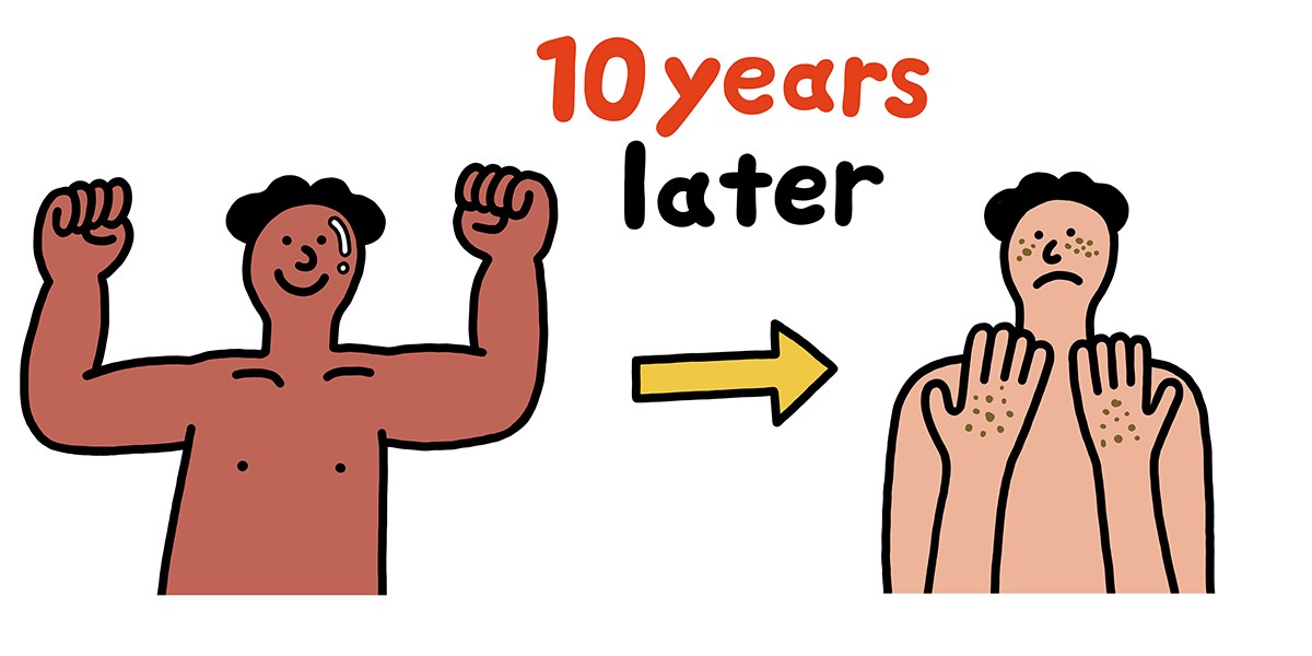 若い頃に日焼けしまくり。日焼けが10年後のシミになるって本当ですか?