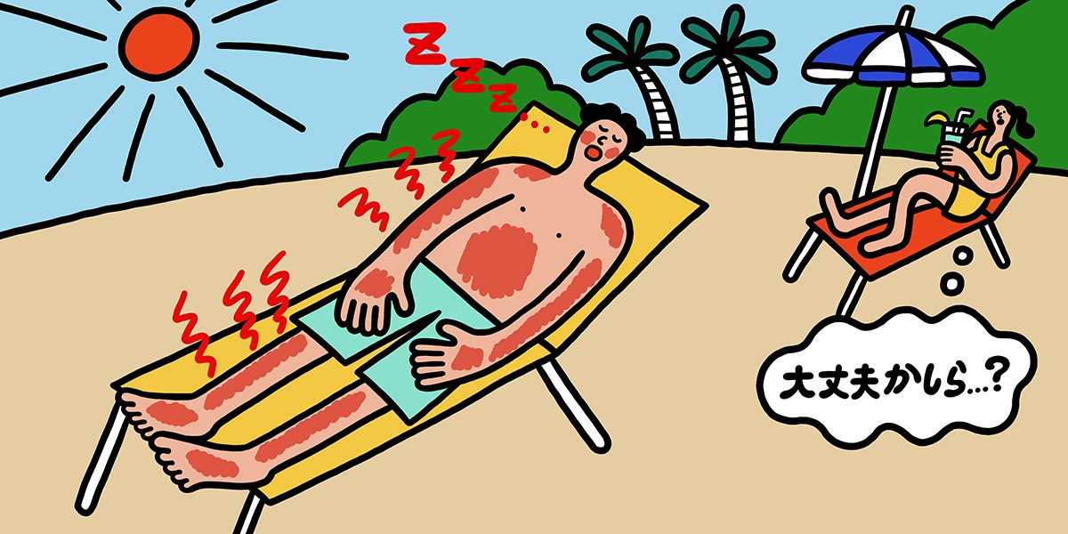 うっかり日焼けしがちです。そんな時、オヤジはどうすればいいですか?