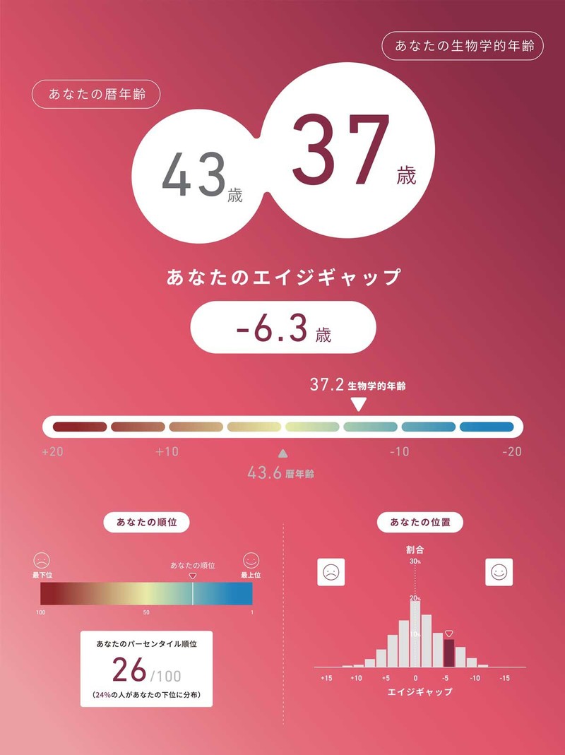SNSでは教えない！ 今月のジローラモのアレやコレ！　エピクロック®