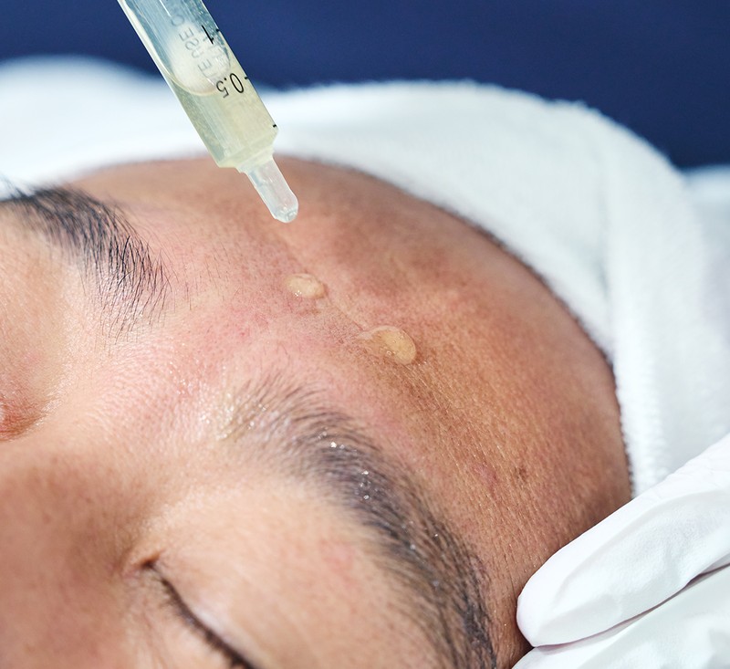 ダウンタイムほぼなしで速攻ハリツヤ肌に「ピーリング&浸透美容」