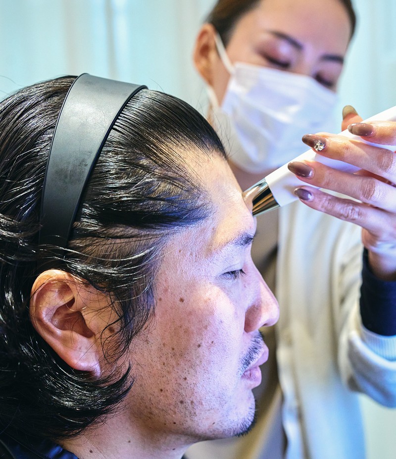 老け見えしていた肌印象を激変させる!?「シミ&ホクロ一掃レーザー」