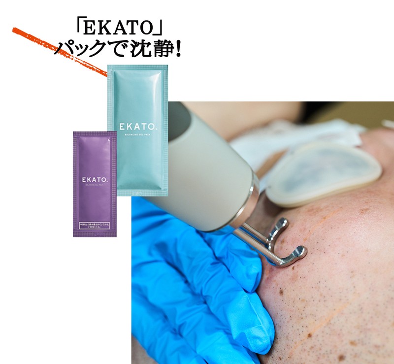 老け見えしていた肌印象を激変させる!?「シミ&ホクロ一掃レーザー」